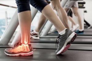 9 nguyên nhân gây mỏi cổ chân khi chạy