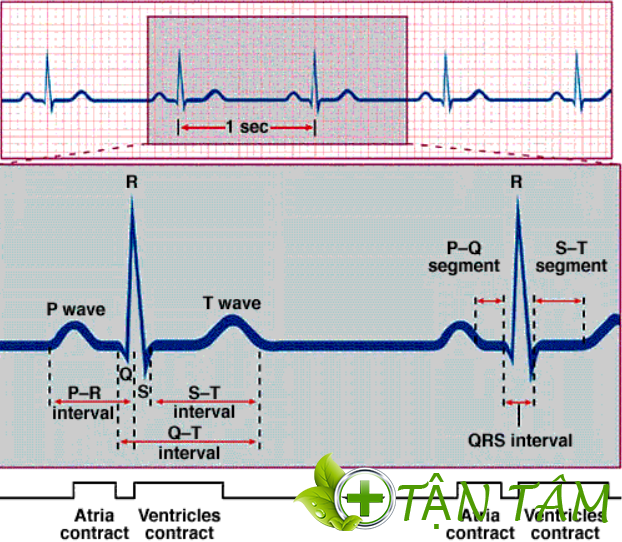 Phức bộ QRS bình thường và bệnh lý trên điện tâm đồ 